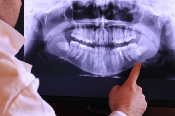 Best Emergency Cosmetic Dentistry in Homestead Valley, CA